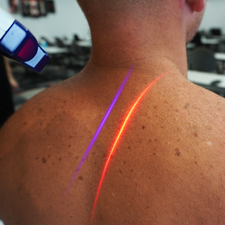 Low Level Laser Therapy Treatment